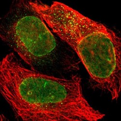 SUN1 Antibody, Novus Biologicals 0.1mL; Unlabeled:Antibodies, Polyclonal